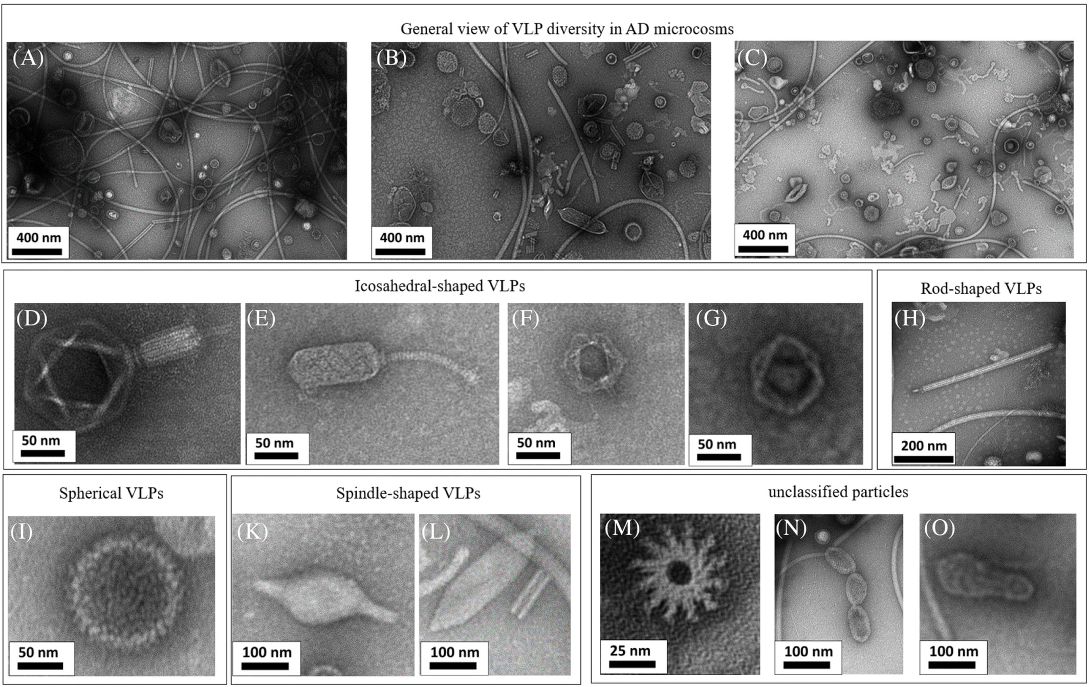 Morphotypic diversity of VLPs in different microcosms, observed by TEM